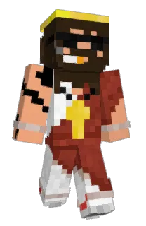 Front of SiggiSiegesmund's skin